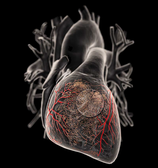 Heart - SPECT Imaging