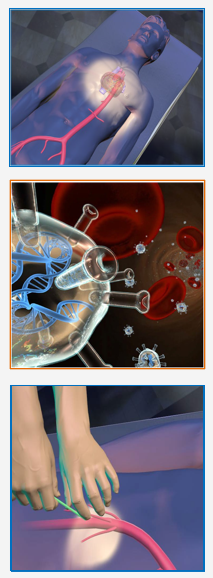 revascularization